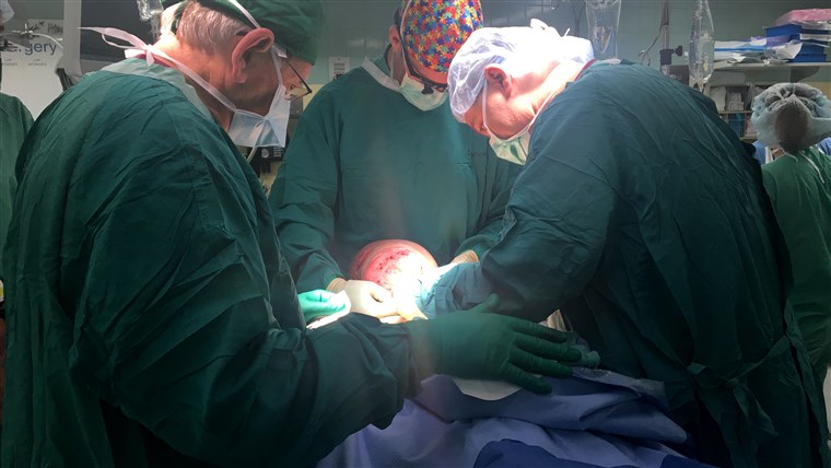 U a 12-hour surgery, doctors removed a 10 pound tumor from 14-year-old Emanuel Zayas face.