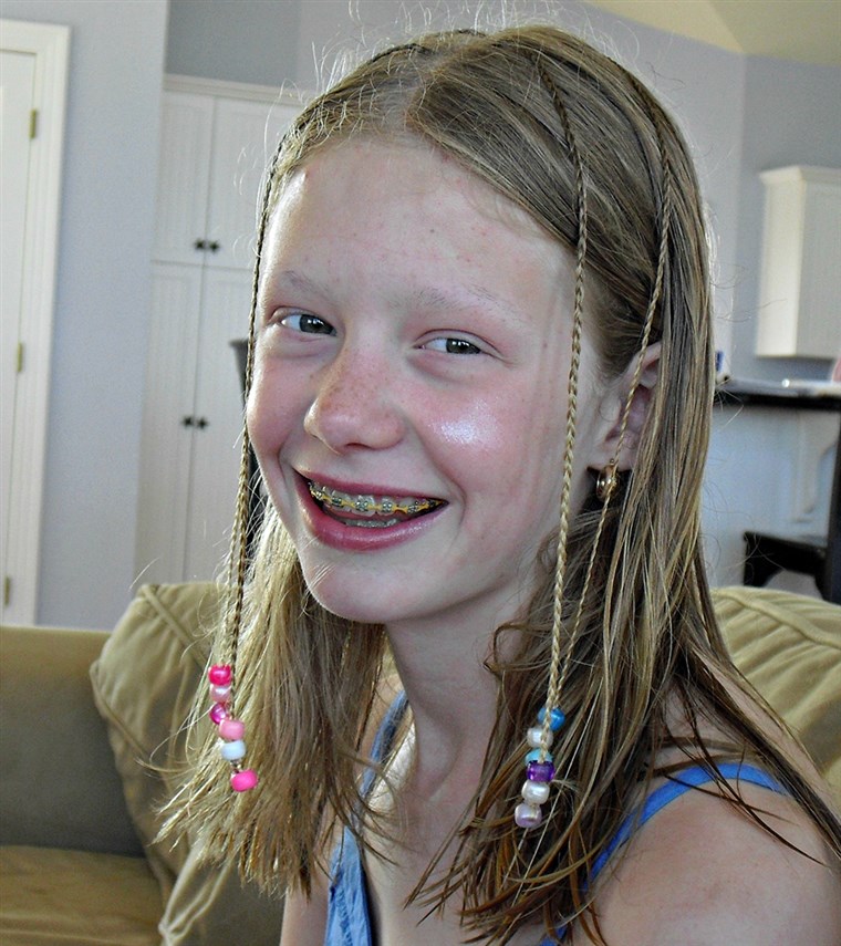 Sara Pennington, a teen who suffers from trichotillomania, a hair pulling disorder.