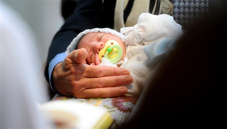 א newborn closes his eyes during his circumcision ceremony. The rate of circumcision in the U.S. has fallen.