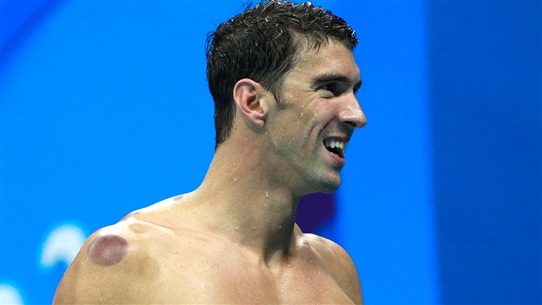 माइकल Phelps cupping