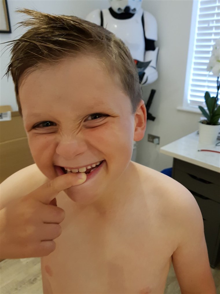 Sam Warren, a London boy who received a note from the tooth fairy, shows off the spot of the tooth he most recently lost.