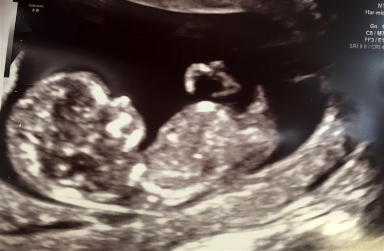 डायलन Dreyer announces she is pregnant with a baby boy
