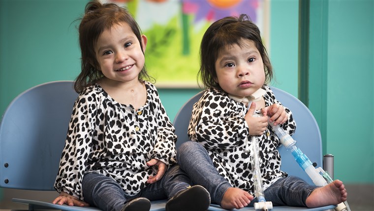 पूर्व conjoined twins Knatalye Hope and Adeline Faith Mata visiting Texas Children’s a few weeks before the one year anniversary of their historic separation surgery.