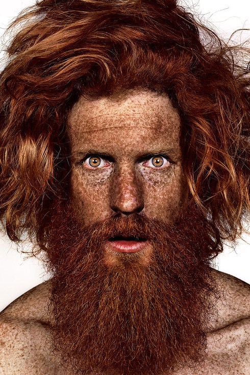 שון Conway participates in photographer Brock Elbank's #Freckles series.