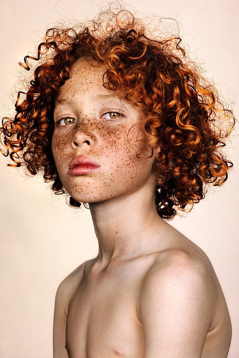 ל his #Freckles series, photographer Brock Elbank states he's received hundreds of emails from applicants of 