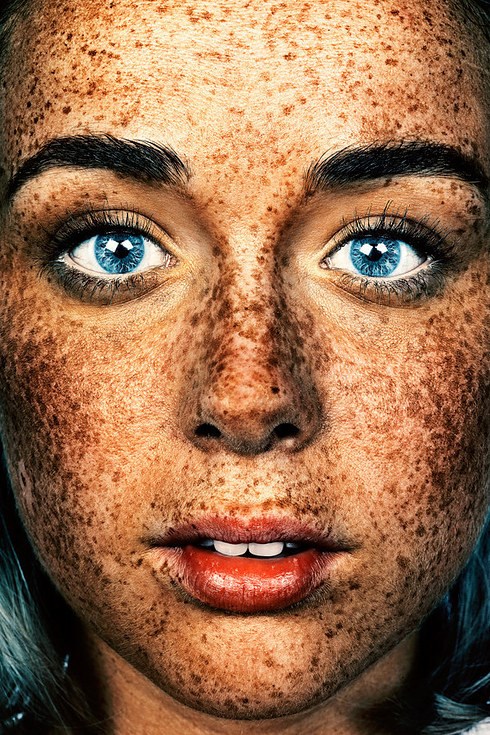 ה #Freckles series began as a single image taken in 2012 by photographer Brock Elbank.