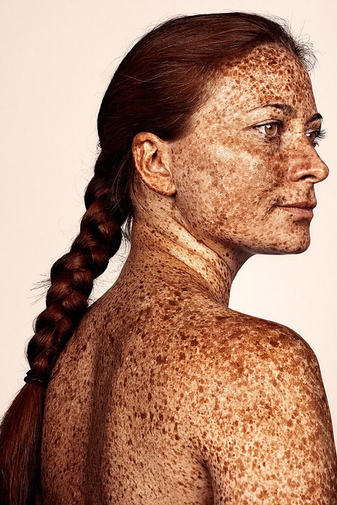 בריטי photographer Brock Elbank has gone viral with his #Freckles series.