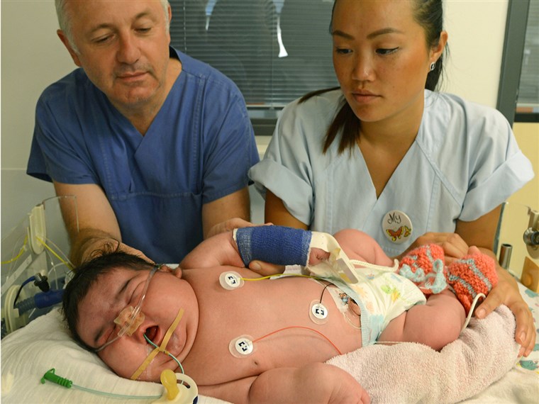 יועץ physician Matthias Knuepfer and nurse My take care of Germany's heaviest newborn until now at the neonatal intensive care ward of the Unive...