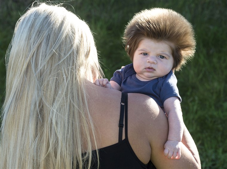 इस baby has a huge head of hair