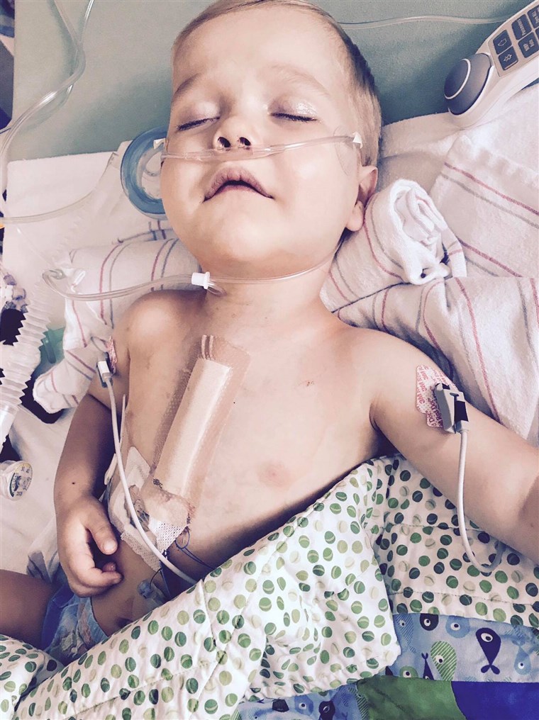 ב his short life, Finn Blumenthal has had 14 procedures, 12 surgeries, and 2 open heart surgeries.