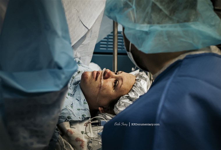 U November 2016, Scholz photographed twin boys being born via C-section.