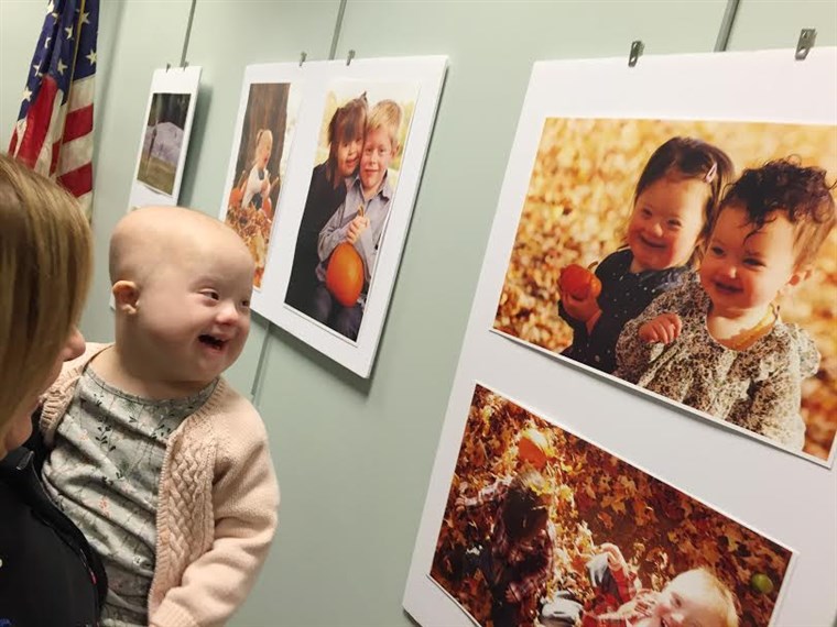 फोटोग्राफर Laura Kilgus captured children with Down syndrome in a photo series