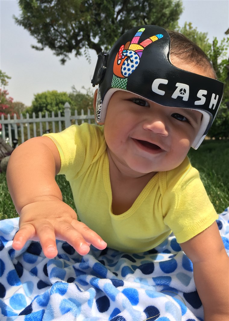 लॉरेन Katunich's husband, David, is a music producer. So when their son, Cash, needed a corrective helmet, the California couple requested that Strawn create a music-inspired headpiece for their baby. 