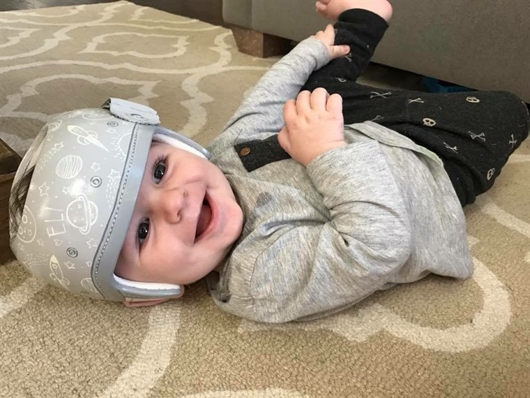 स्टेफ़नी Hanrahan says she struggled with seeing a piece of white plastic strapped to her infant son, Eli's, head. So the Texas mom contacted Strawn for some design help. 
