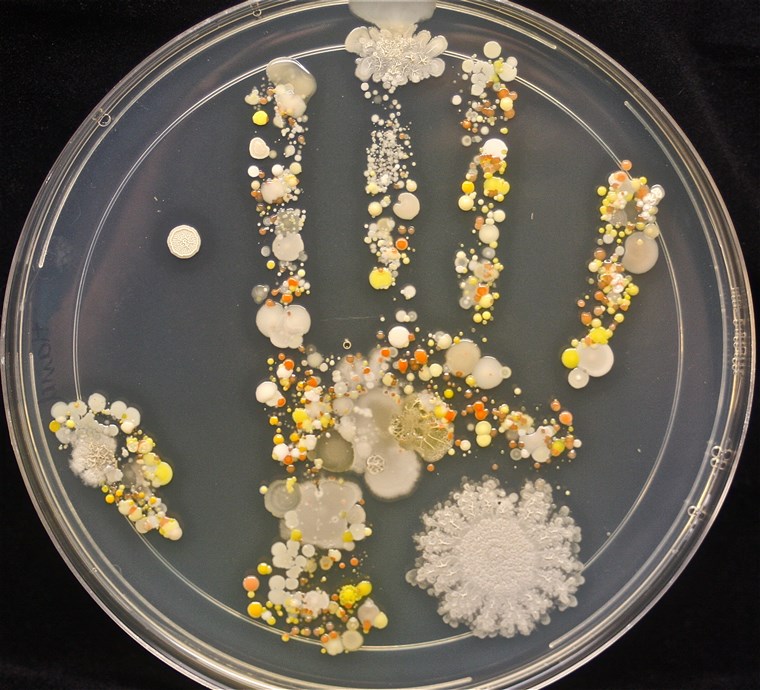 ה 8-year-old boy had been playing outside before he pressed his hand into the Petri dish.