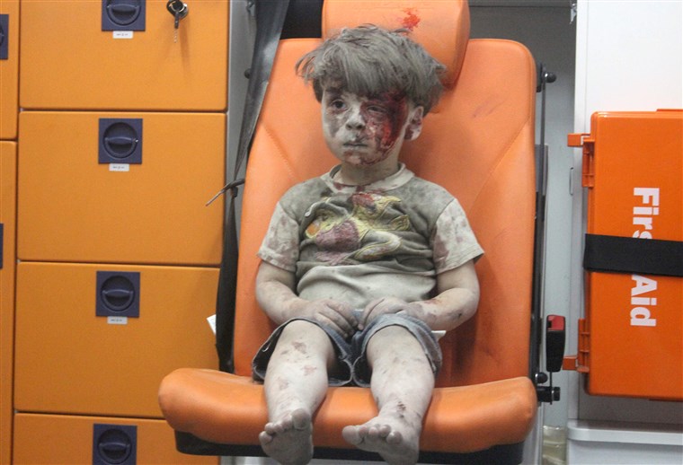 עומראן, a four-year-old Syrian boy