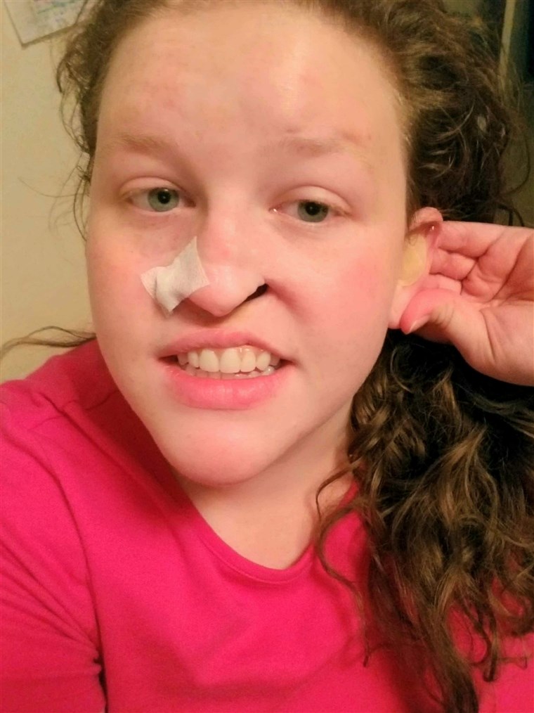 Za the past four years, Marisha Doston has be undergoing various treatments and surgeries for skin cancer. She hopes to raise awareness about the risk of skin cancer.