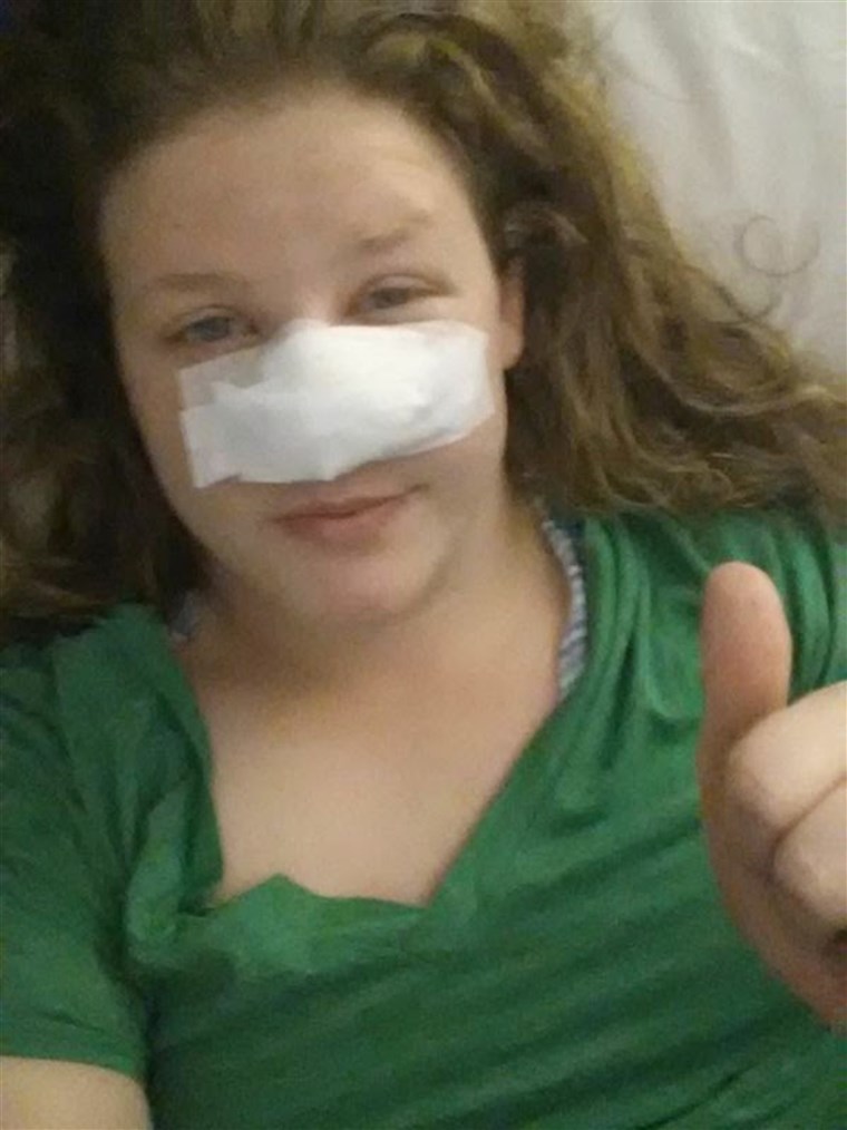 רופאים removed much of Marisha Dotson's nose to stop her cancer. Until she could have reconstruction, she just had an open wound where her nose once was.