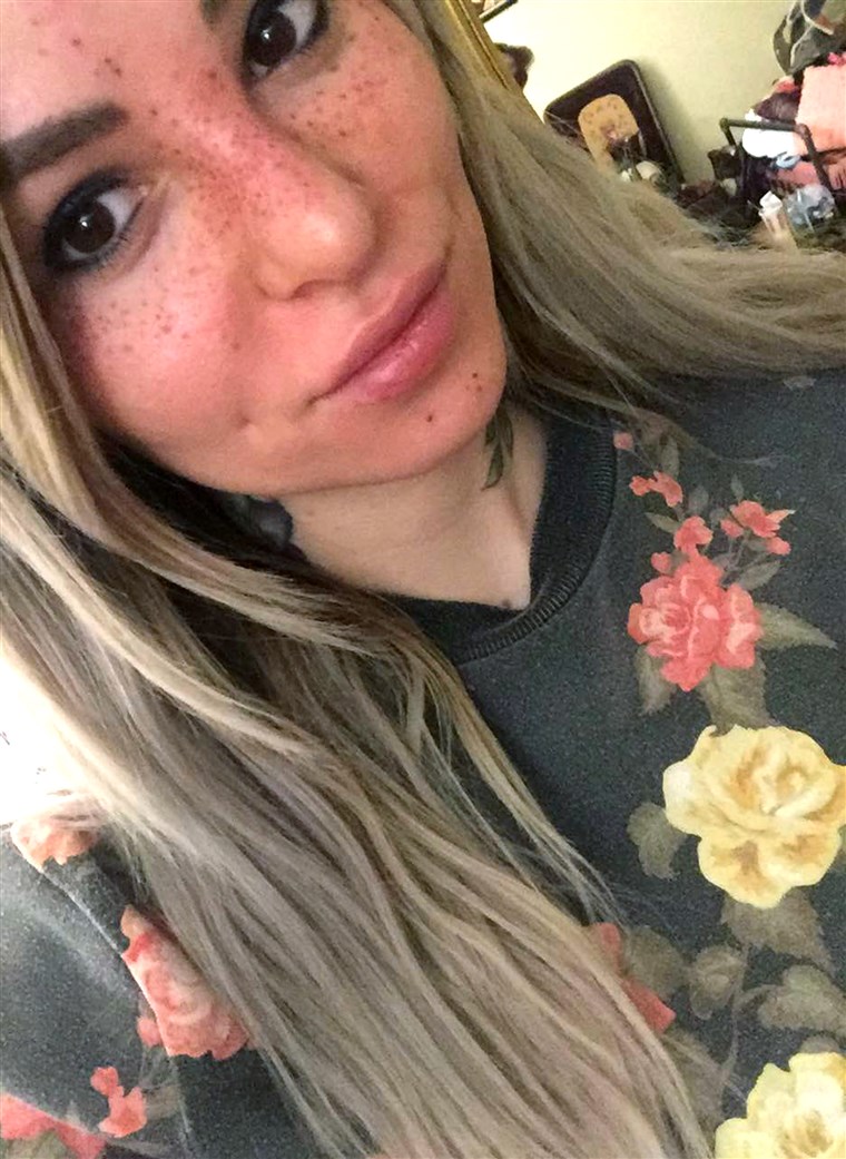 קעקוע artist Sydney Dyer shows off her newly applied freckle tattoos.
