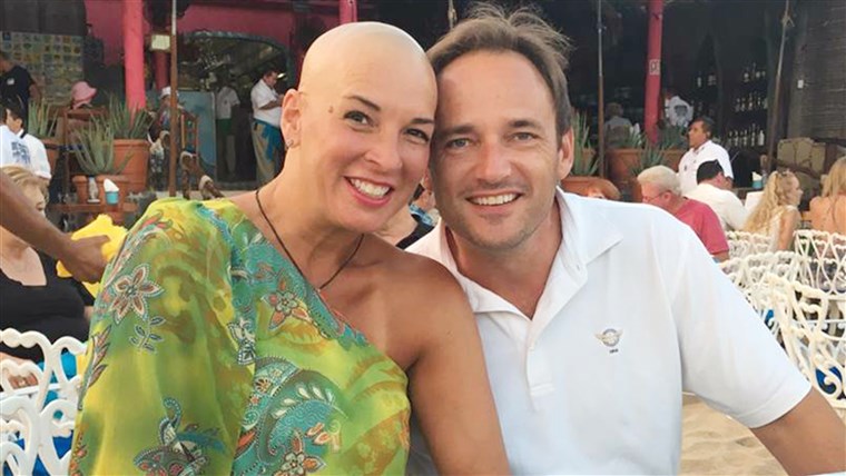 מרגרט Staib, who has alopecia areata.
